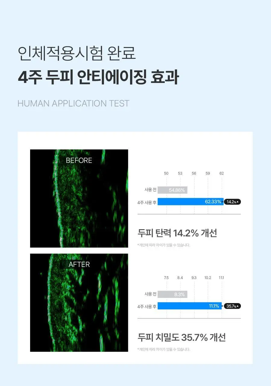 [탄산버블/두피쿨링] 하아르 닥터두피톡스 100ml 상세페이지 10